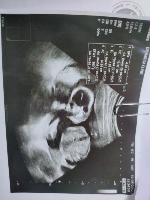 สอบถามหน่อยค้า❤️