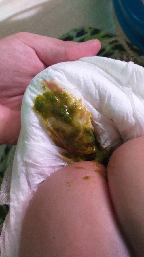 Bab mencret hijau trus