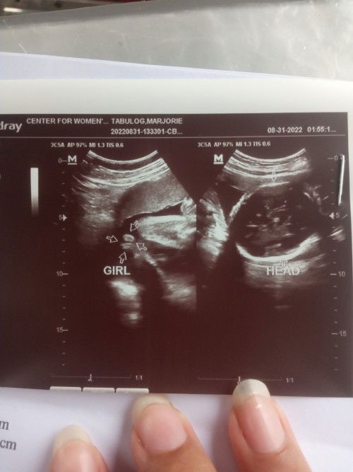 Hi mga momshie and soon to be,tanong kolng po sana kung  girl talaga yong gender ng baby ko