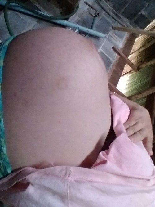 ท้องที่2 37+1