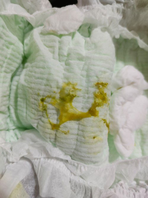 Popo na parang plema