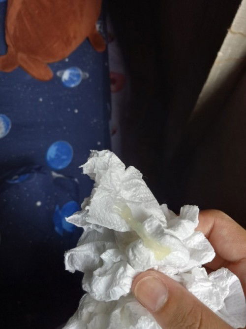 แบบนี้เขาเรียกมูกไหมคะท้องแรกค่ะแต่ไม่เจ็บท้องนานไหมคะน้องจะออก37+6