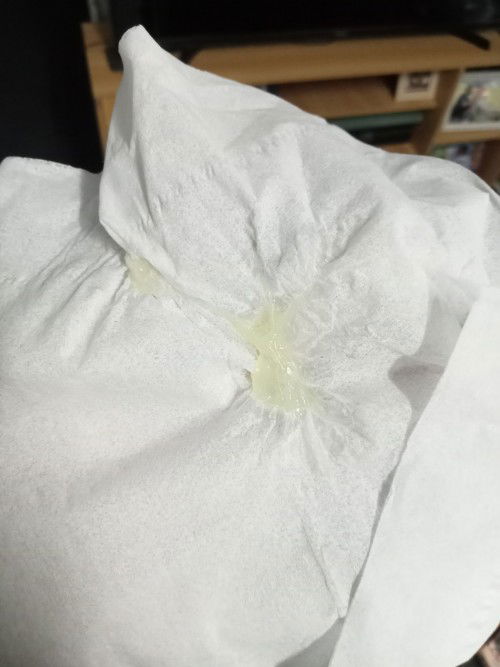 คุนแม่ท้อง38w