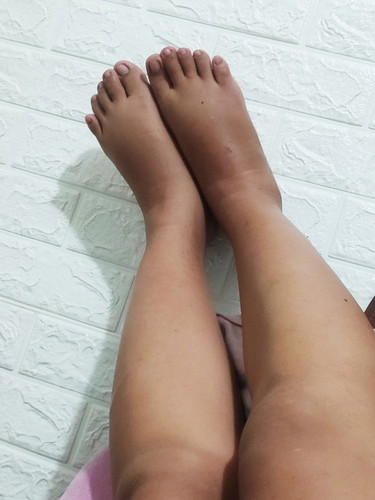 Pagmamanas sa paa @37wks