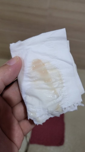 Mucus plug po ba ito?