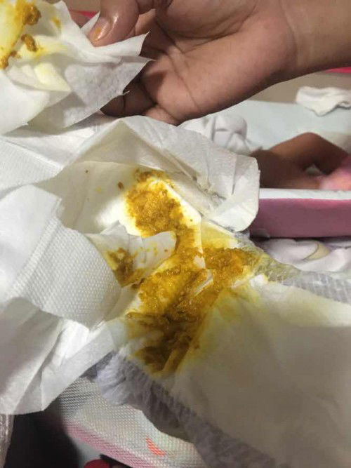 Normal po ba? Pa help po.