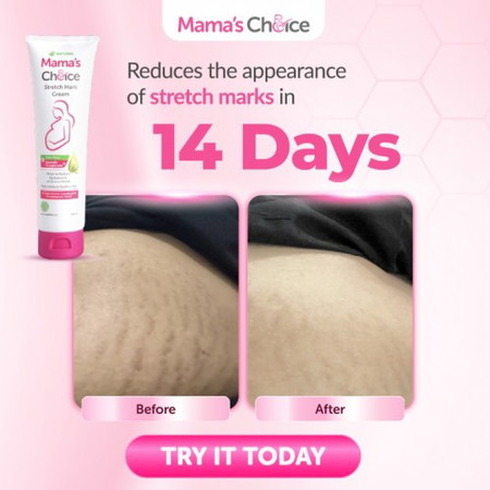 Can your stretch mark cream do this?? 🤔