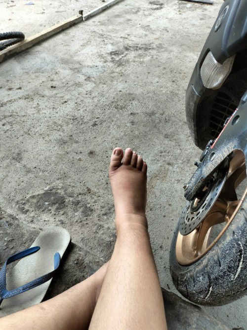Kaki bengkak TM 2