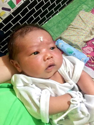 Hi po ss mga Mom's ,ask lang ako about sa new born baby ko 5 dyas na niya ngayon .pula po mata niya