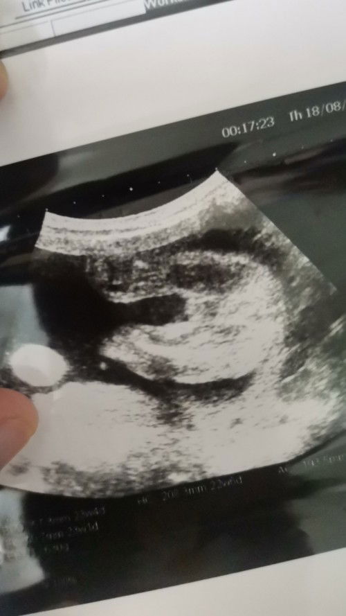 Jantina baby, doc kata boy kakak kata girl.. sec baby first baby x prnh dpt gmbr scan...