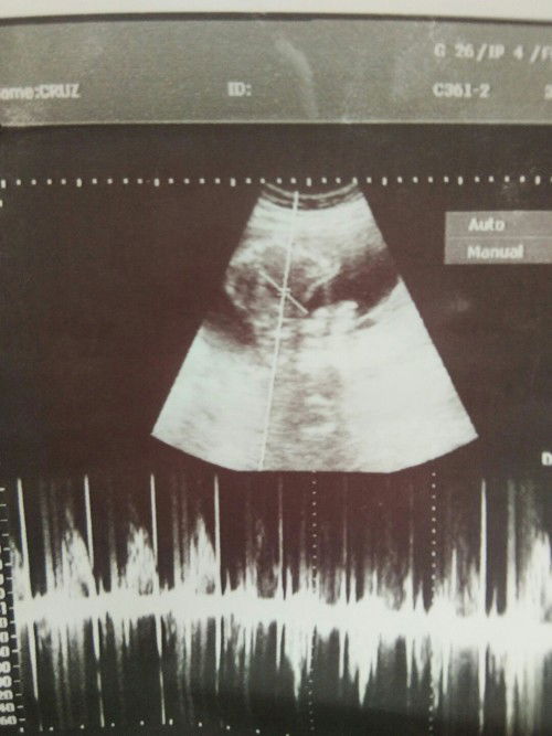 Ask ko lang po sino marunong tumingin ng ultrasound .