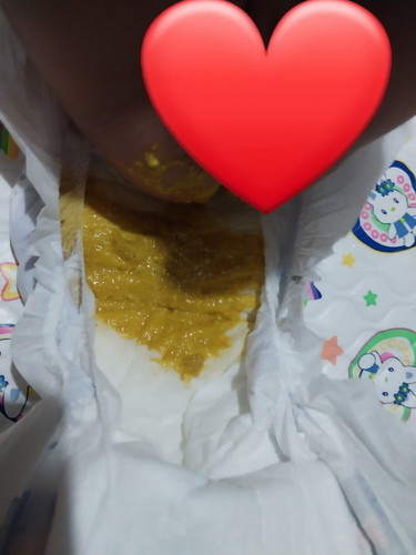 Every after feed nagpoops si baby