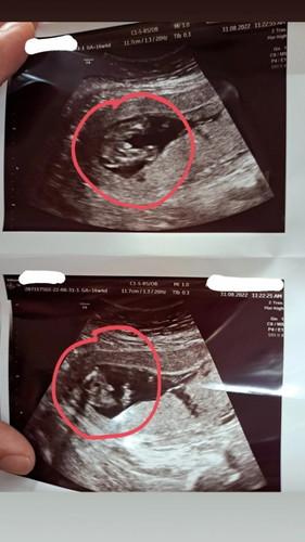 Boy or Girl? 🥰💙🧡