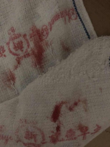Spotting ke bleeding