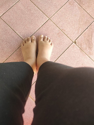 30wเท้าบวมหนักมาก แม่ๆบ้านไหนเริ่มบวมกันกี่วิคค่ะ บวมตึงแต่ไม่ปวด ความรู้สึกหนักเท้ามาก