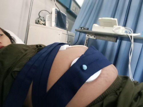 Bayi sungsang.......