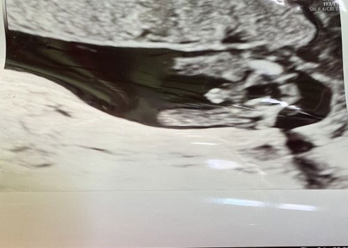 แม่ๆ ช่วยดูเพศน้องให้หน่อยค่า