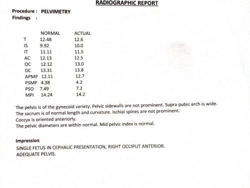 Pelvimetry Result