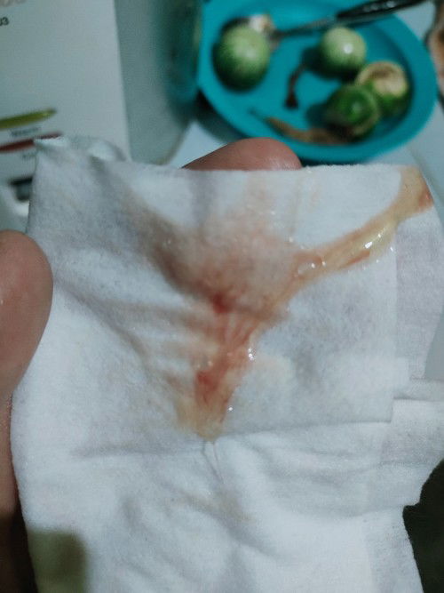 Keluar lendir darah 40 week