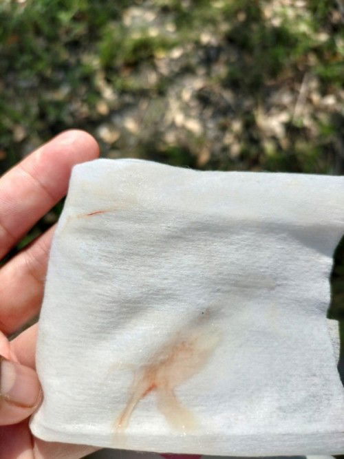 มีมูกเลือดออกมาเเต่ไม่มีอาการปวดท้องเลยค่ะควรไปพบแพทย์มั้ยค่ะ