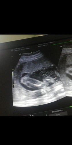 Boy or girl?