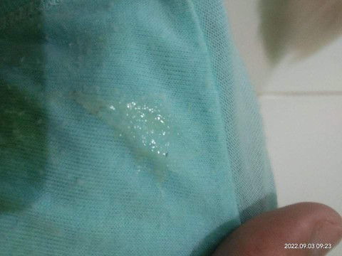 Maaf bun mau tanya nih.. 
Dari pagi tadi saya kerasa perut kram
Perut kenceng,,terus keluar lendir