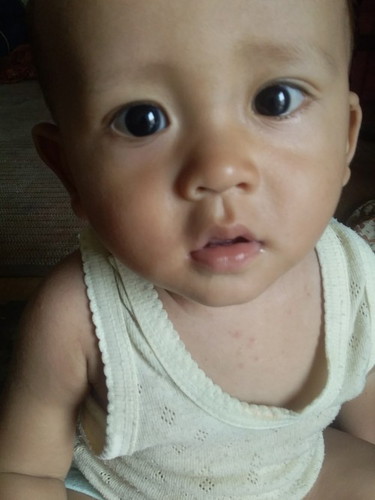 Bun kenapa ya anak saya setiap habis makan pasti BAB. Badannya jadi ga naik2 . Apakah bahaya bund?