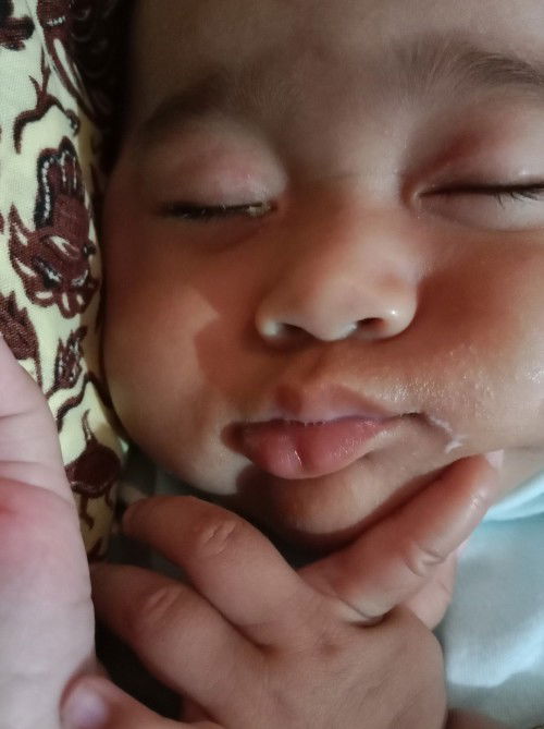 Mata bayi berair dan belekkan warna hijau