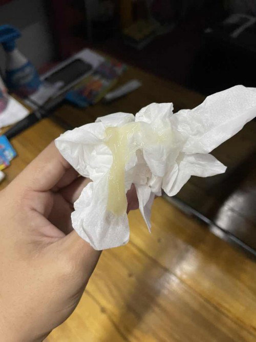 มีแม่ๆคนไหนเป็นแบบนี้บ้างไหมคะ มีอาการท้องแข็ง ปวดหลัง คลื่นไส้ ละก็มีมูกไหลออกมา 
อายุครรภ์ 38+3 สัปดาห์ค่ะ