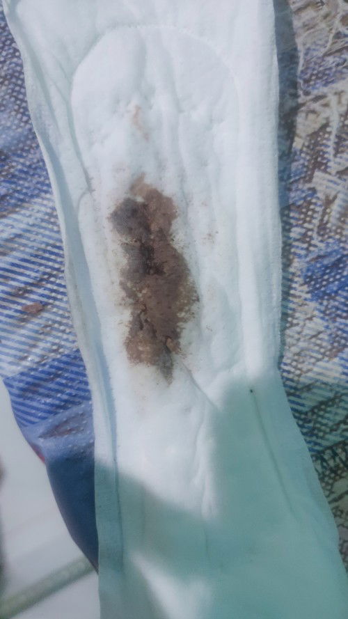 Tanya hamil 6minggu ngeflek