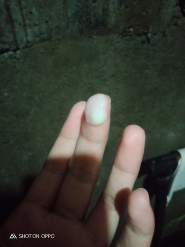 Normal lang ba