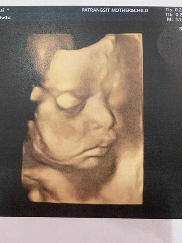 อายุครรภ์29w3d กังวลเรื่องหัวลูกมีขนาดเล็ก