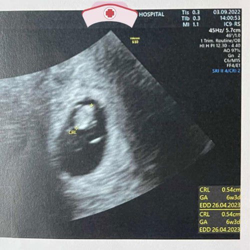 อายุครรภ์ ผิดปกติ