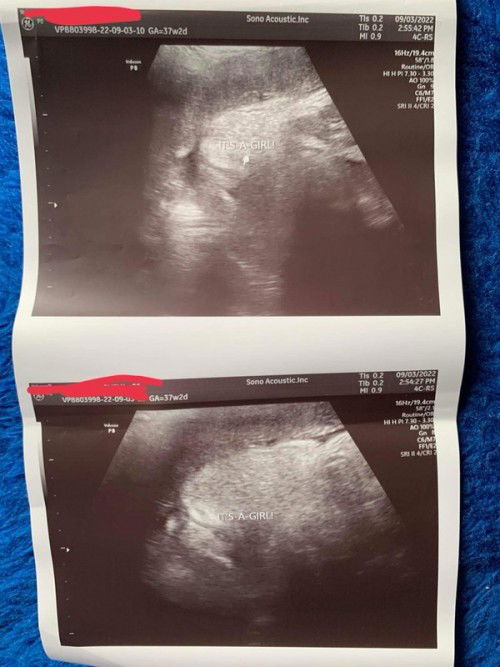 Girl na ba talaga? Sana mapansin niyo po ako 🥺