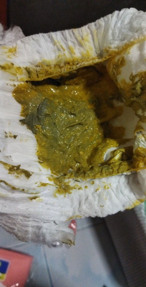 ช่วยดูสีอึน้องให้หน่อยว่าปกติมั้ยคะ กังวลมากเลย