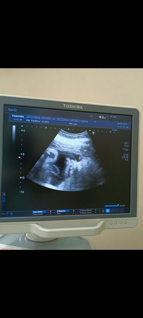 33w3d น้ำหนัก2518กรัมค้าบ