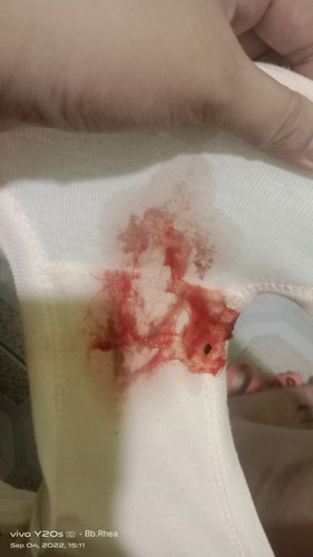 Bloody discharge