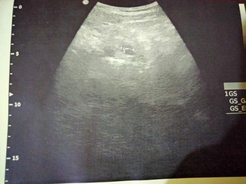 Ada yg sama kah bun?