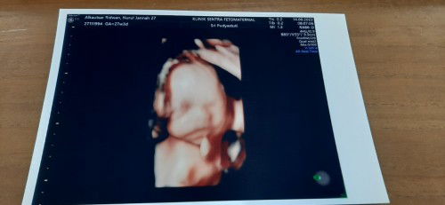 Teruntuk Malaikat Kecil Mama