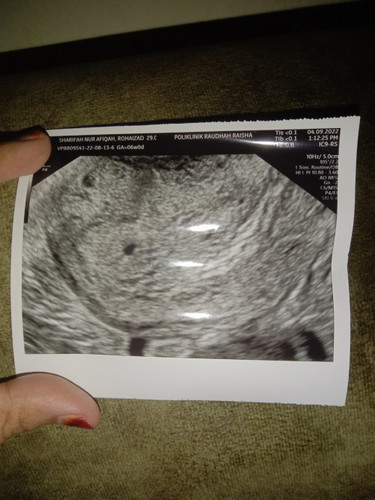 Pregnant second baby