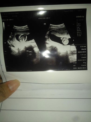 Sharing,sedikit minta saran