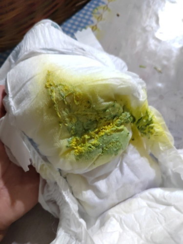 Najis bayi kuning + hijau