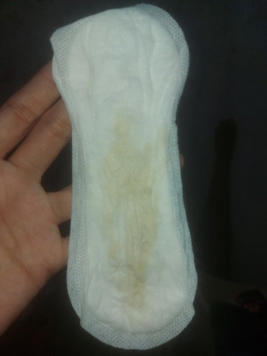YELLOWISH DISCHARGE