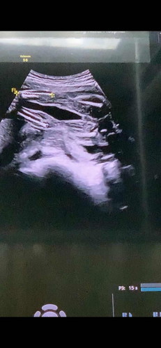 ช่วยดูเพศลูกให้หน่อยค่ะแม่ๆ ว่าน้องเป็นหญิงหรือชาย😂