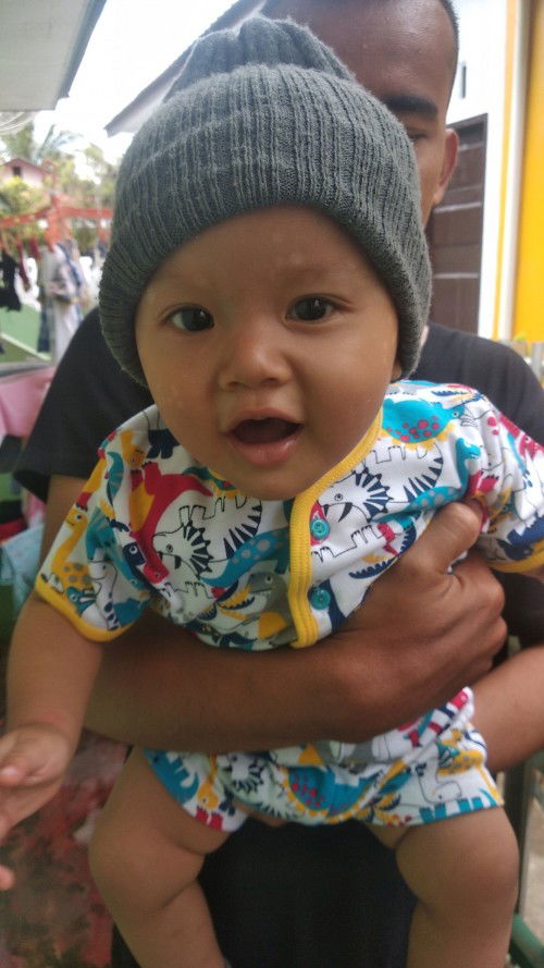 Bintik putih di wajah:(