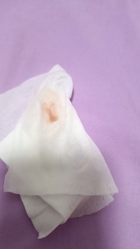 มีมูกออกอาการไกล้คลอดใช่ไหมคะ