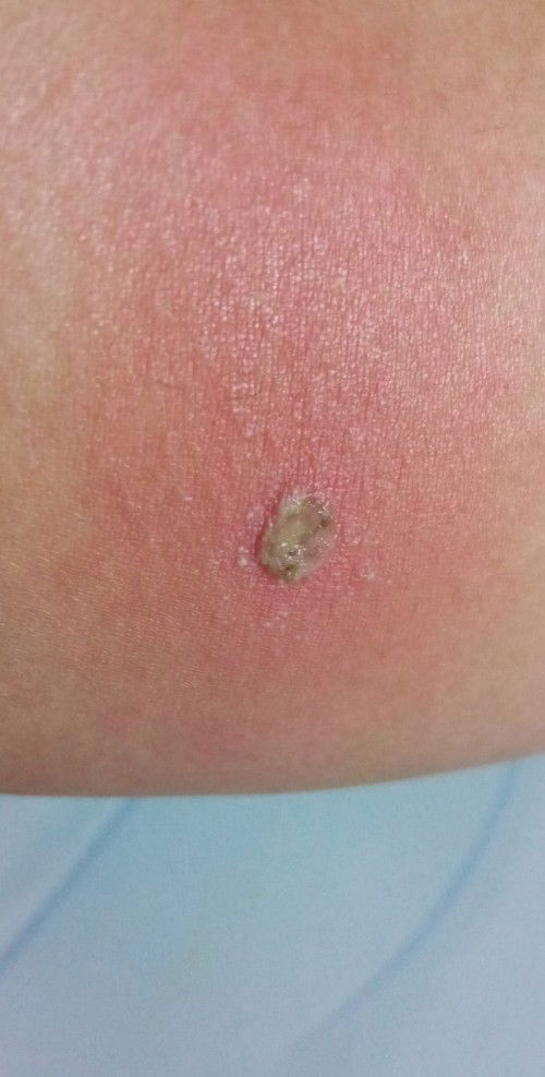 Sakit kulit saat hamil