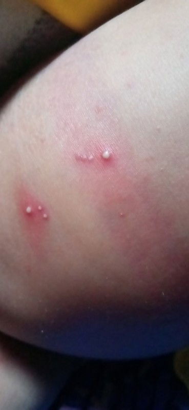 Bun ada yg tau ini kenapa anak sya bru 5 hari