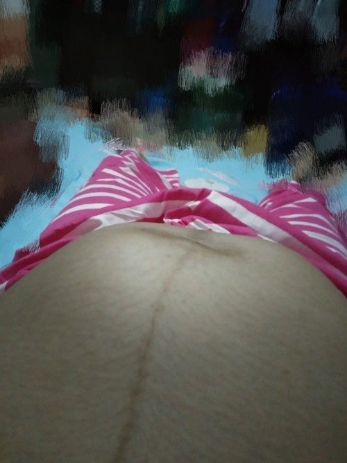 แบบนี้น้องโก่งตัวหรืออะไรคะ