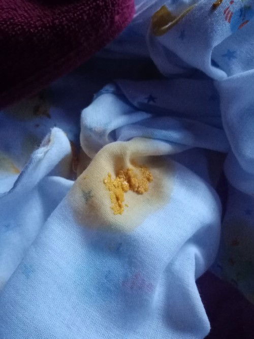 อึลูกน้อยอายุ 7 วัน แบบนี้ถือว่าปกติไหมค่ะ